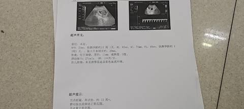 journal_insert_pic_1684850627