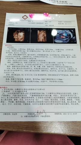 journal_insert_pic_1677999997