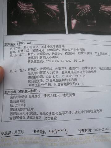 journal_insert_pic_1690063731