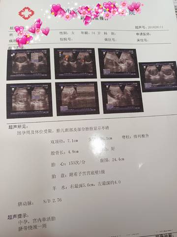 journal_insert_pic_1688973963