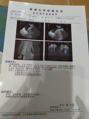 journal_insert_pic_1677219002