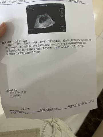 journal_insert_pic_1673404300