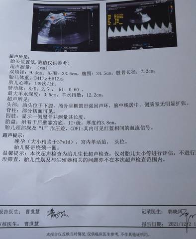 journal_insert_pic_1677397837