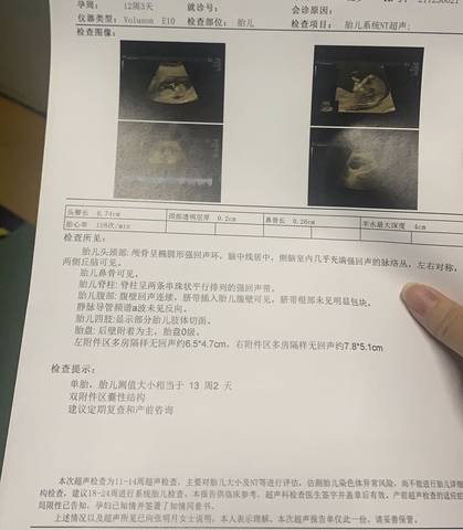 journal_insert_pic_1689059505