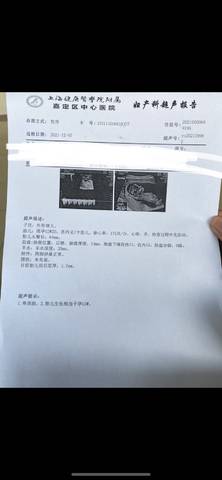 journal_insert_pic_1676225597