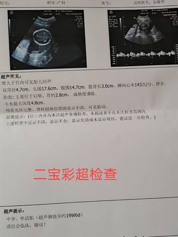 journal_insert_pic_1676677568