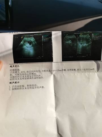 journal_insert_pic_1674160876