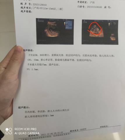 journal_insert_pic_1674670983