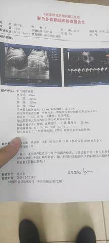 journal_insert_pic_1684262909