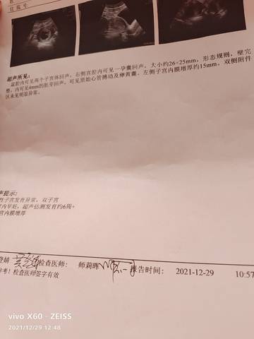 journal_insert_pic_1688272170