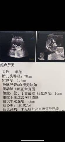 journal_insert_pic_1684829162