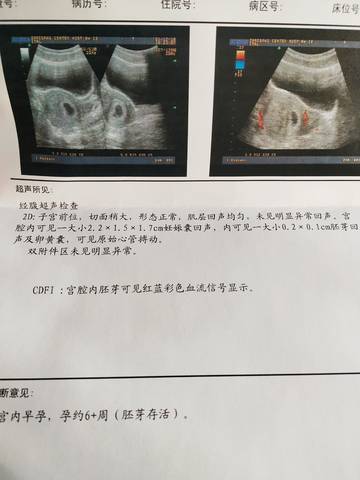 journal_insert_pic_1682250930