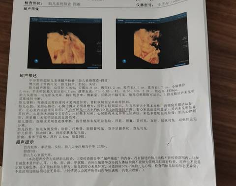 journal_insert_pic_1686721121