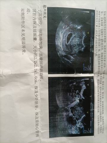 journal_insert_pic_1685355214