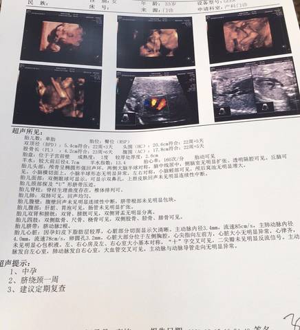 journal_insert_pic_1685316063