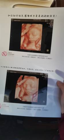 journal_insert_pic_1675070606