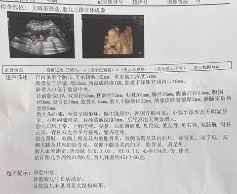 journal_insert_pic_1674890800