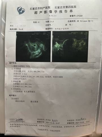 journal_insert_pic_1686092965