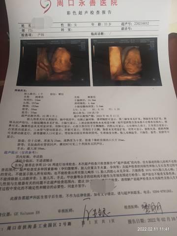 journal_insert_pic_1719789009