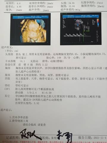 journal_insert_pic_1675368572