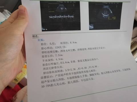 journal_insert_pic_1683925476