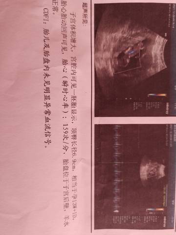 journal_insert_pic_1683659813