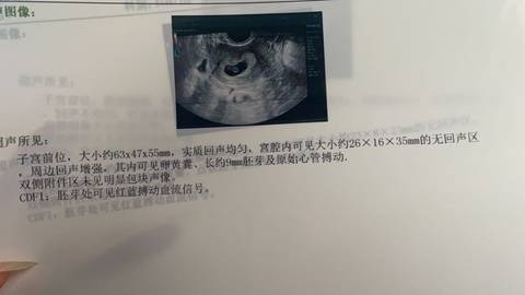 journal_insert_pic_1689301297