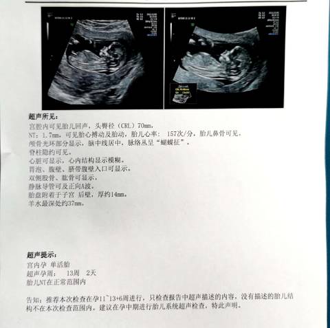 journal_insert_pic_1676655584