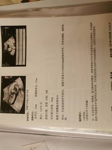 journal_insert_pic_1690279622