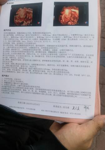 journal_insert_pic_1685250928