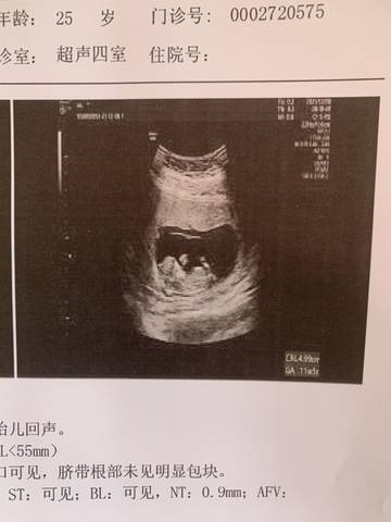 journal_insert_pic_1675947307