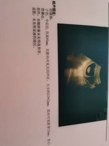 journal_insert_pic_1677423127