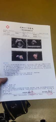 journal_insert_pic_1720028094