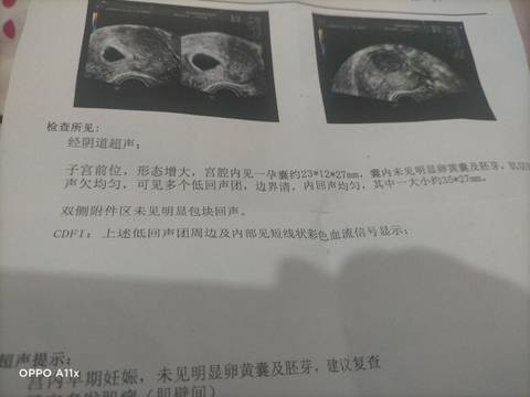journal_insert_pic_1681145829