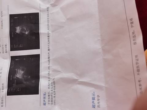 journal_insert_pic_1719599385