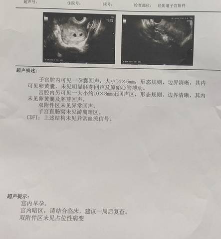 journal_insert_pic_1683034679