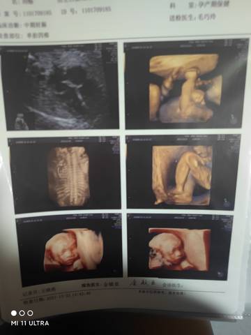 journal_insert_pic_1678898419