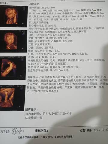 journal_insert_pic_1689027430
