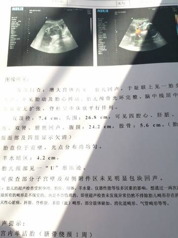 journal_insert_pic_1679560280