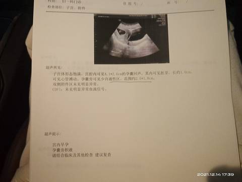 journal_insert_pic_1679820004