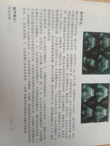 journal_insert_pic_1677401573