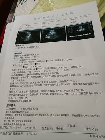 journal_insert_pic_1676039819