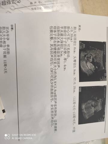 journal_insert_pic_1683616287