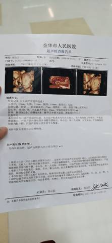 journal_insert_pic_1683758545