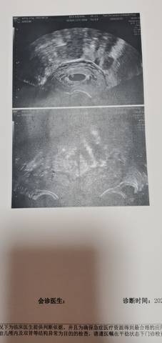 journal_insert_pic_1686344789
