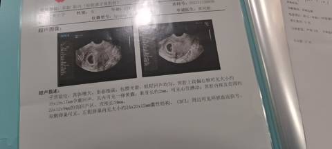 journal_insert_pic_1681586903