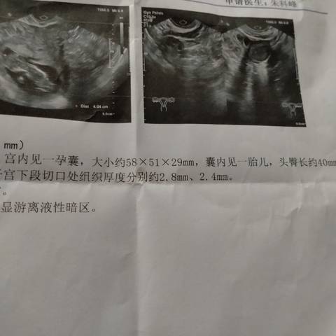 journal_insert_pic_1686591061