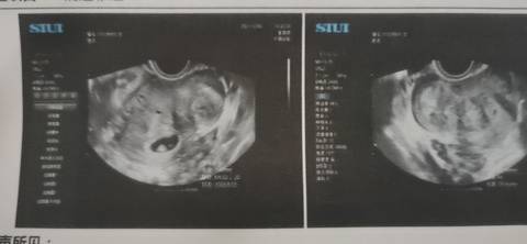 journal_insert_pic_1689059363