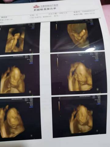 journal_insert_pic_1684053402