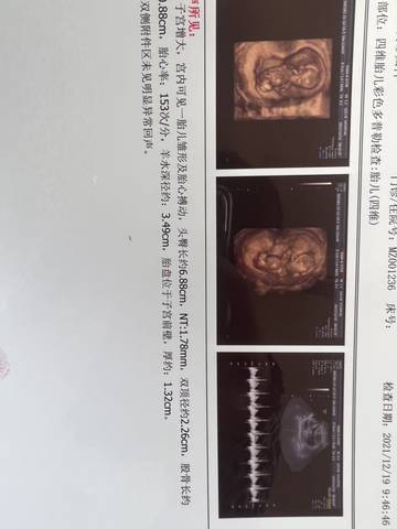 journal_insert_pic_1683202959